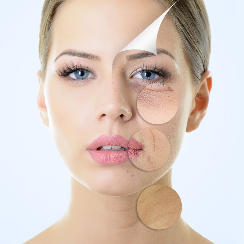 Die Aquafacial-Gesichtsbehandlung ist ein modernes Hautpflegesystem für die Tiefenreinigung sowie das Einschleusen passender Wirkstoffe