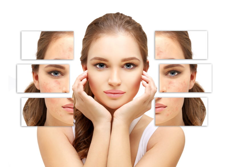 Der Behandlungsablauf ähnelt dabei dem der klassischen Gesichtsbehandlung, wobei neben dem Schwerpunkt der porentiefen Ausreinigung